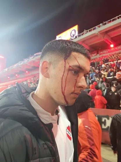 Independiente - U de Chile