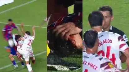 Tomás Palacios, desatado: patada a la cabeza, sangre, expulsión y chispazos con Sebastián Zunino Tomás Palacios, desatado: patada a la cabeza, sangre, expulsión y chispazos con Sebastián Zunino